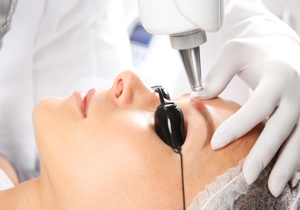 Por qu ofrecer el borrado del microblading de cejas en tu centro